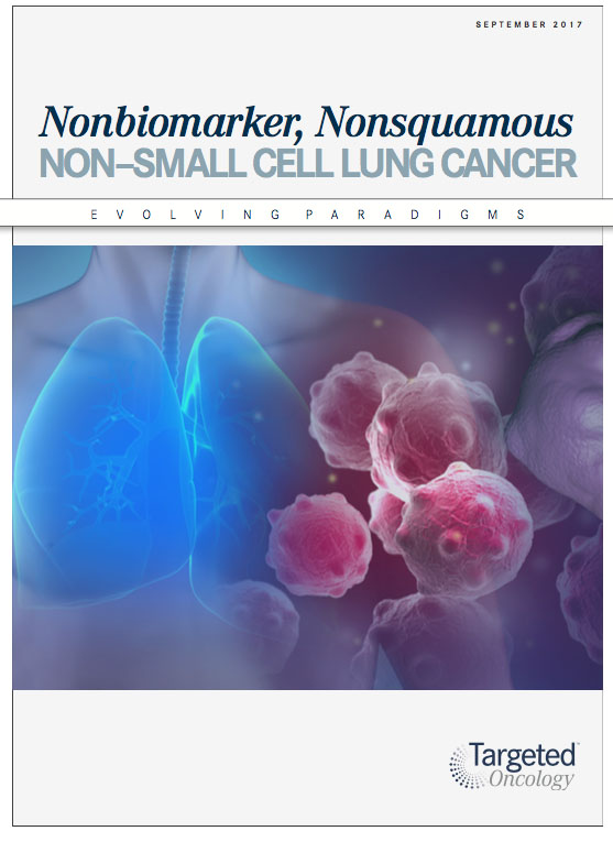 Evolving Paradigms Mantle Cell Lymphoma