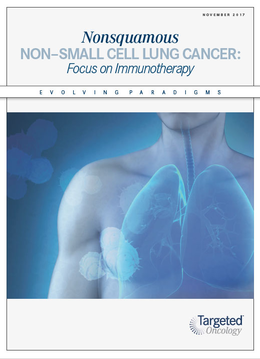 Evolving Paradigms Mantle Cell Lymphoma