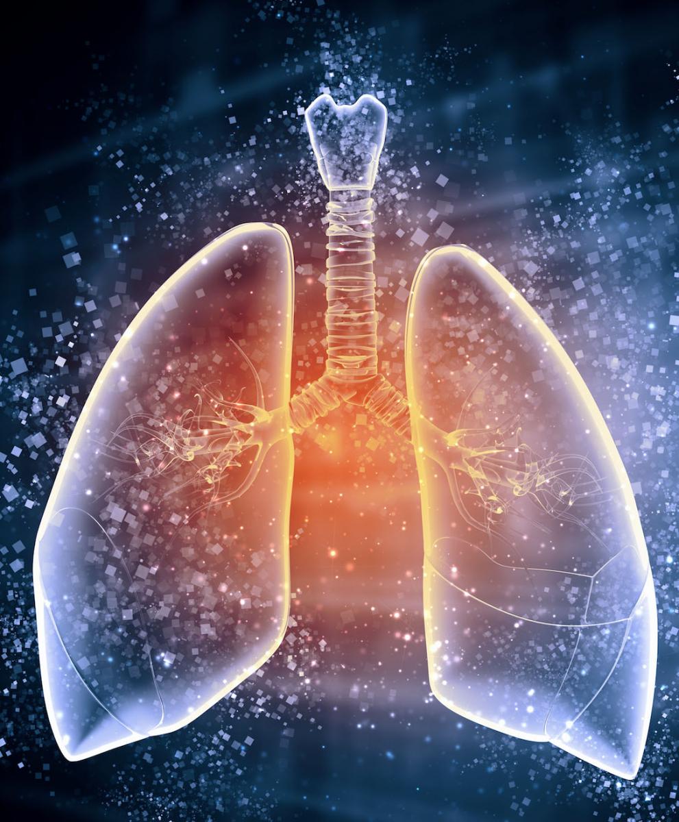 lung cancer Lung cancer